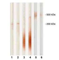 Anti-PAPP A antibody [18A10] used in Western Blot (WB). GTX10196